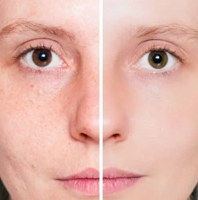 перекись водорода